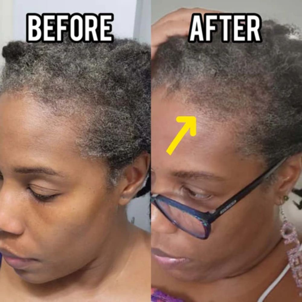 Stimulating Thickening Hair Growth Oil | Nourish, Strengthen & Support Healthy Growth